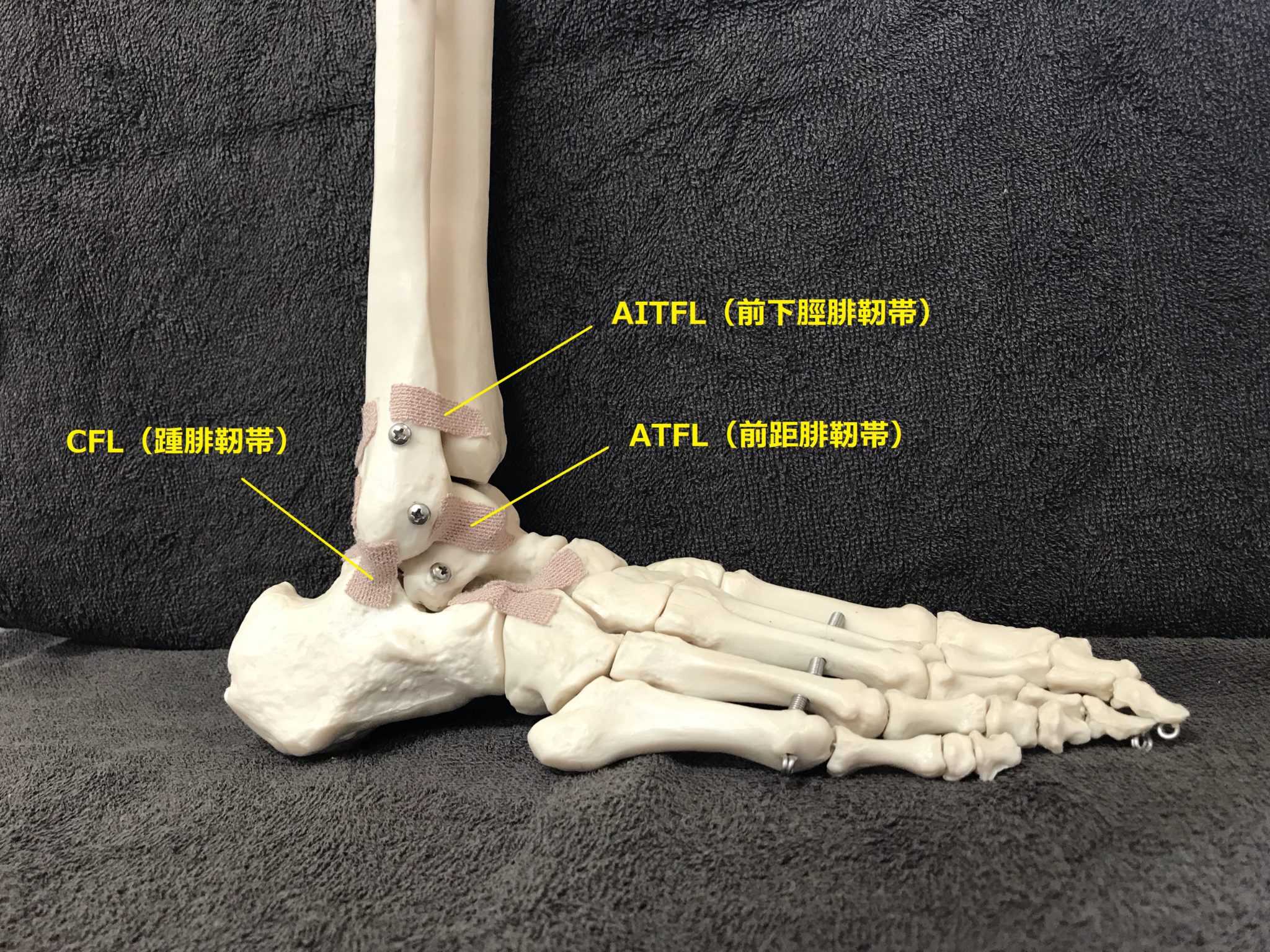 踵 腓 靭帯